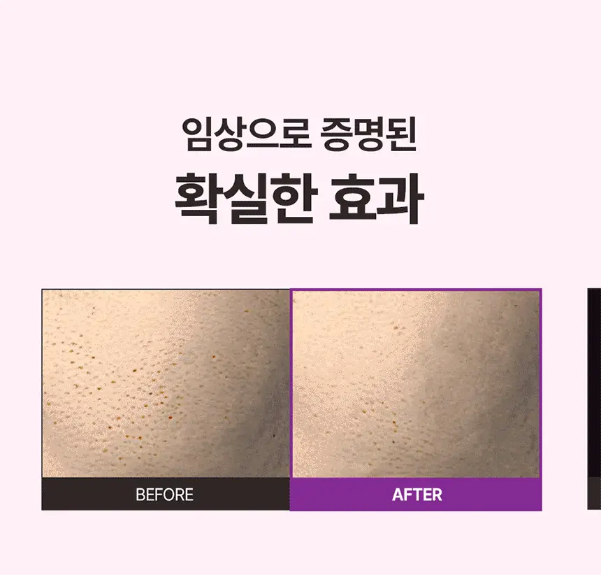 [모공탄력/매끈쫀광]비건이펙트 콜라겐 랩핑 마스크팩80ml(+브러쉬증정) 상세페이지 10